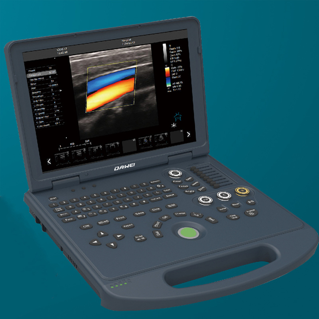 Rh-E9l3 Laptop Color Doppler al equipo médico del hospital